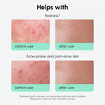 Redness Soothing Azelaic Acid Serum