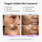 Face & Body Serum for Dark Spots