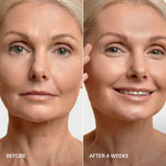 Pro-Retinol Neck Lifting Cream Massager
