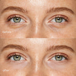 Pink Eye Patches for Puffy Eyes